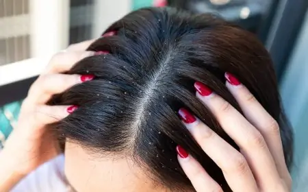 பெண்களே… பொடுகு தொல்லையால் அவதிப்படுகிறீர்களா..? அப்ப கண்டிப்பா படிங்க..!