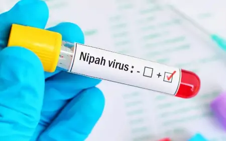 இலங்கையில் நிபா வைரஸ்? வெளியான தகவல்!