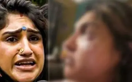 முகத்தில் காயத்துடன் வனிதா விஜயகுமார்; ரசிகர்கள் அதிர்ச்சி