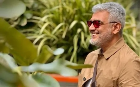 சிகிச்சை முடிந்து வீடு திரும்பிய நடிகர் அஜித்