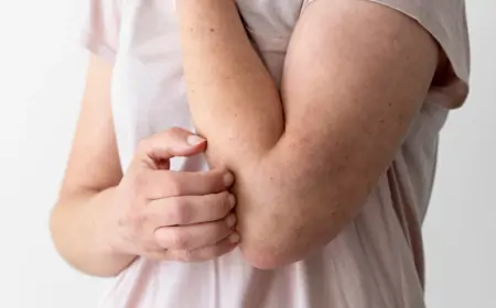 நாட்டில் பரவி வரும் தொற்று நோய் குறித்து எச்சரிக்கை