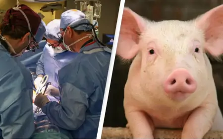 பன்றியின் சிறுநீரகத்தை மனிதனுக்கு பொருத்தி சாதனை படைத்த அமெரிக்க மருத்துவர்கள் 