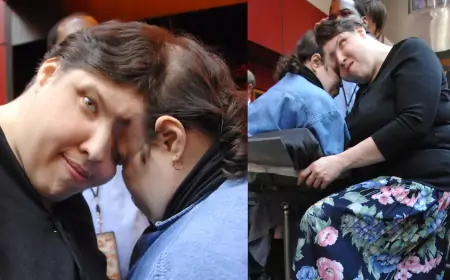 உலகின் மிக வயதான ஒட்டி பிறந்த இரட்டை சகோதரிகள் மரணம்!