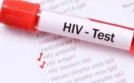 இளைஞர்களுக்காக HIV பரிசோதனைகளை அதிகரித்துள்ள சுகாதார அதிகாரிகள்!