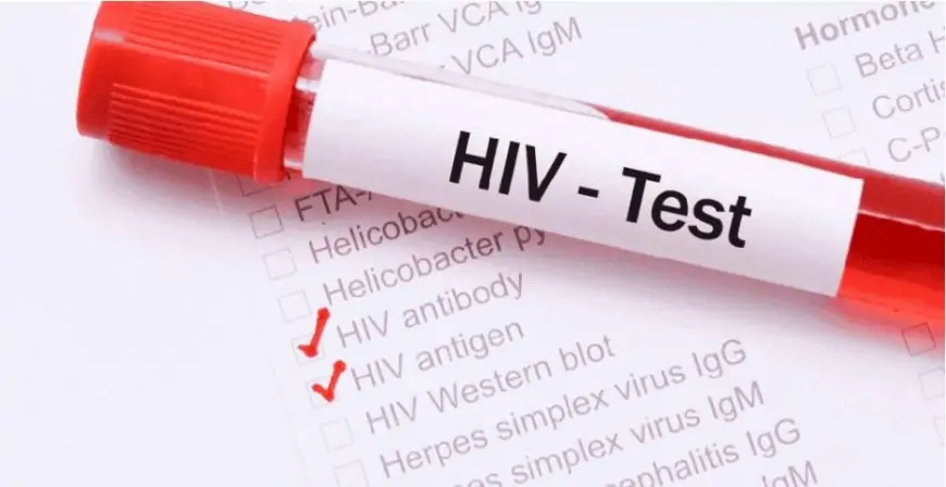 இளைஞர்களுக்காக HIV பரிசோதனைகளை அதிகரித்துள்ள சுகாதார அதிகாரிகள்!