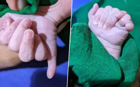 25 விரலுடன் பிறந்த அதிசிய குழந்தை; வைத்தியர்கள் கூறிய தகவல்!