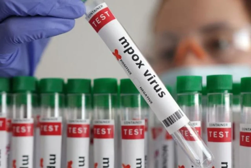 'Surprising' New Case of Mpox Variant Clade lb Detected in England