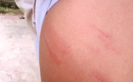 விளையாடியதற்காக 5ஆம் வகுப்பு மாணவர்களை கடுமையாக தாக்கிய அதிபர்!