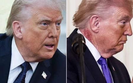 டிரம்ப் கழுத்தில் தோன்றிய மாற்றம்: வெள்ளை மாளிகை அறிக்கையால் வெளிவந்த உண்மை?